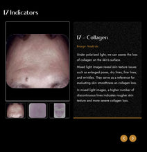Load image into Gallery viewer, 2025 JuvaMap AI 17 Indicator 3D Skin Analyzer with Included 13.3” Android Tablet