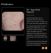 Load image into Gallery viewer, 2025 JuvaMap AI 17 Indicator 3D Skin Analyzer with Included 13.3” Android Tablet