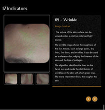 Load image into Gallery viewer, 2025 JuvaMap AI 17 Indicator 3D Skin Analyzer with Included 13.3” Android Tablet