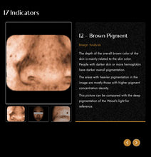 Load image into Gallery viewer, 2025 JuvaMap AI 17 Indicator 3D Skin Analyzer with Included 13.3” Android Tablet