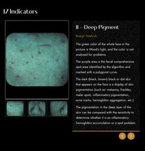 Load image into Gallery viewer, 2025 JuvaMap AI 17 Indicator 3D Skin Analyzer with Included 13.3” Android Tablet