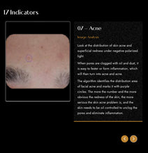 Load image into Gallery viewer, 2025 JuvaMap AI 17 Indicator 3D Skin Analyzer with Included 13.3” Android Tablet