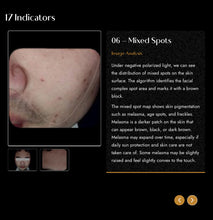 Load image into Gallery viewer, 2025 JuvaMap AI 17 Indicator 3D Skin Analyzer with Included 13.3” Android Tablet