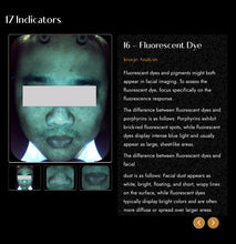 Load image into Gallery viewer, 2025 JuvaMap AI 17 Indicator 3D Skin Analyzer with Included 13.3” Android Tablet