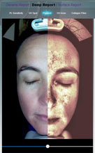 Load image into Gallery viewer, 2025 JuvaMap AI 17 Indicator 3D Skin Analyzer with Included 13.3” Android Tablet