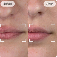 Load image into Gallery viewer, New JuvaPlump 4 Mode LED Red Light Therapy Lip Plumper and Smile Restorer Mask