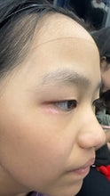 Load image into Gallery viewer, 2026 JuvaLamp Philips Professional BU-10 UVB Acne Vitiligo Psoriasis Eczema Lamp
