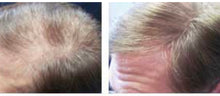 Load image into Gallery viewer, New ManeWave Red Light Therapy Hair Restoration System with O2 and Electrotherapy