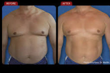 Load image into Gallery viewer, New Liposlim 360° Red Laser Lipo System for Non Surgical Fat Removal
