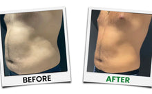 Load image into Gallery viewer, New Limelight 360° 6D Green Laser Lipo System for Non Surgical Fat Removal
