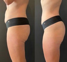 Load image into Gallery viewer, New 2026 JuvaBun HEMG® (High Efficiency Muscle Gain) Butt Lifting Sculpting Contouring Fat Burning Chair

