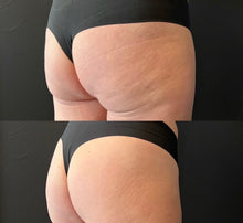 Load image into Gallery viewer, New 2026 JuvaBun HEMG® (High Efficiency Muscle Gain) Butt Lifting Sculpting Contouring Fat Burning Chair
