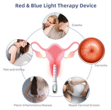 Load image into Gallery viewer, JuvaBuzz Portable Vaginal Rejuvenation Red Blue LED Light Vibration Wand
