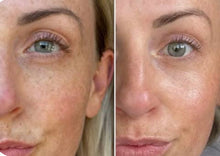 Load image into Gallery viewer, New JuvaShield Multi Wavelength LED Red Light Therapy Face Mask
