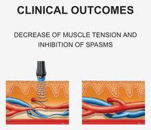 Load image into Gallery viewer, JuvaSoft Radial Extracorporeal Shockwave Therapy Machine
