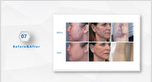 Load image into Gallery viewer, 2024 CarbonLaze Fractional Co2 Laser Skin Resurfacing Machine
