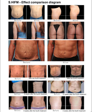 Load image into Gallery viewer, New Release LiteForce™ 10D Red Light Therapy Green Laser Therapy and EMS 3 in 1 Fat Reduction Body Contouring and Muscle Building Machine

