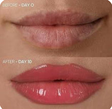 Load image into Gallery viewer, New JuvaPlump 4 Mode LED Red Light Therapy Lip Plumper and Smile Restorer Mask
