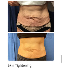 Load image into Gallery viewer, New JuvaGainX EMG ® Efficient Muscle Gain Muscle Building Fat Burning Body Sculpting Machine
