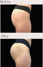 Load image into Gallery viewer, New JuvaGain 6 Mode EMG ® Efficiency Muscle Gain Massage Physiotherapy Belt with Red Light Therapy
