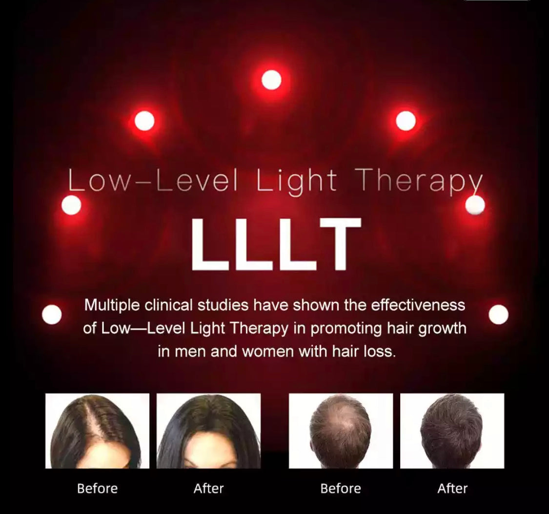 Red Light Therapy for Hair Loss: Does it Really Work?